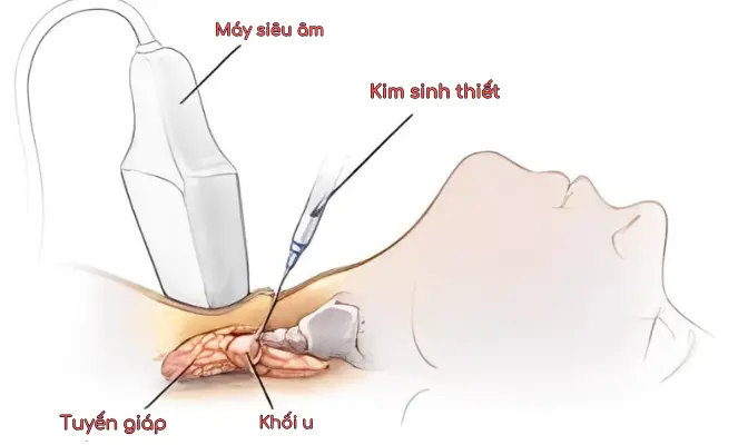 Page benh ly tuyen giap 6