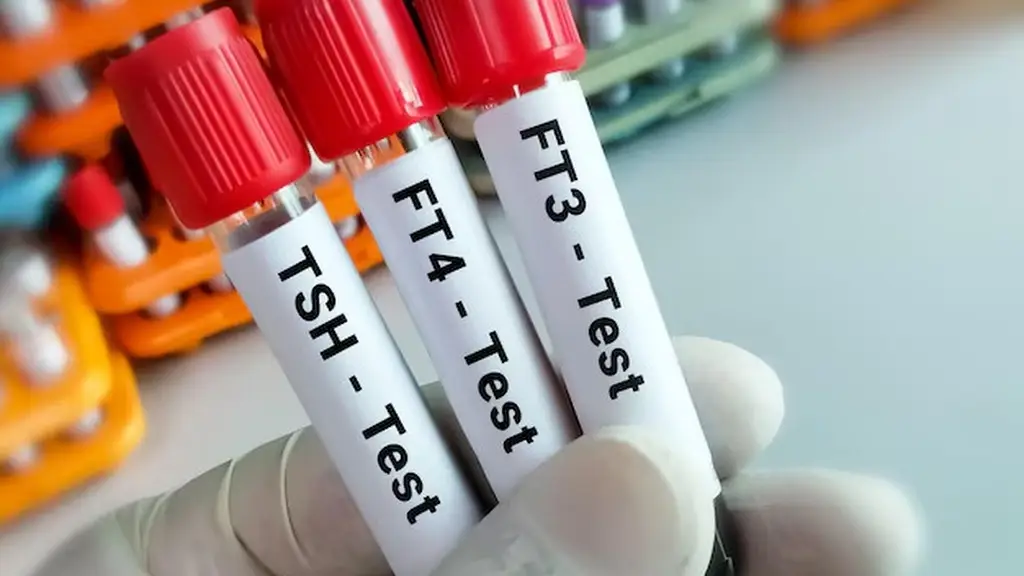 Xét nghiệm Hormone tuyến giáp - Nhận định đúng để phòng ngừa và điều trị hiệu quả image 1