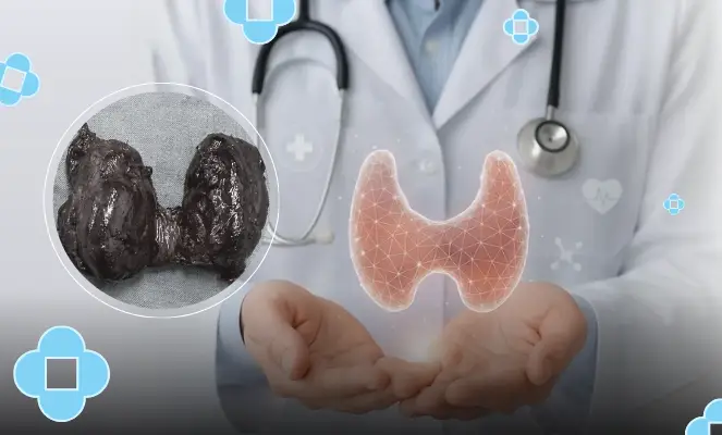 Page benh ly tuyen giap 1