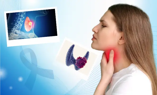 Page benh ly tuyen giap