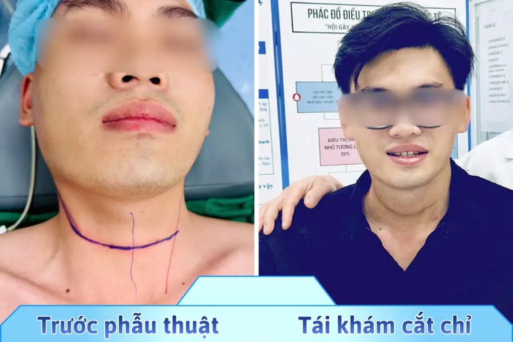 FB 1 anh 1200 x 800 1