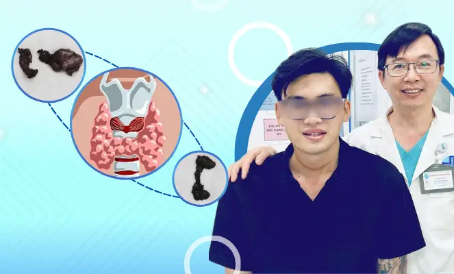 Page benh ly tuyen giap 3