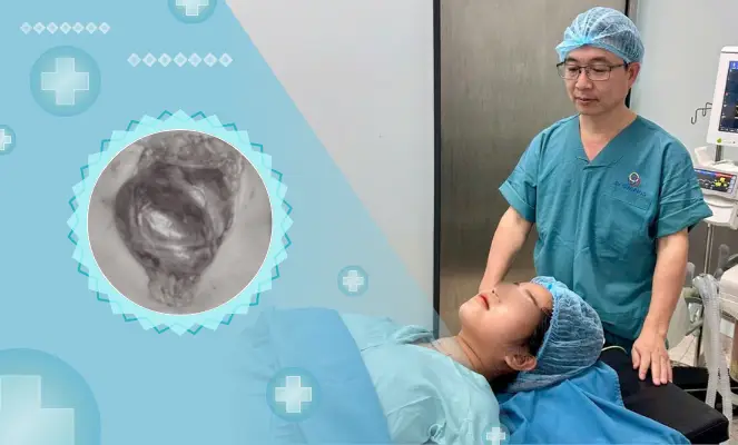 Page benh ly tuyen giap 1