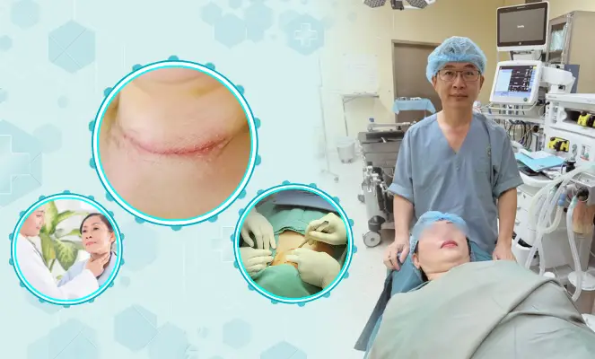 Page benh ly tuyen giap